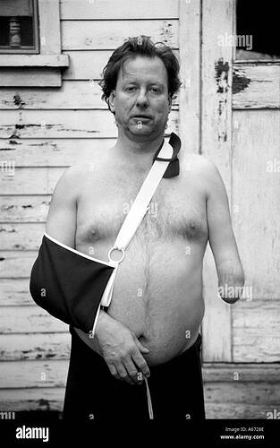 un-hombre-armado-con-un-buen-brazo-en-cabestrillo-a6728e
