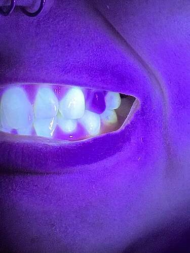 fake-teeth-dont-glow-under-black-light-real-teeth-do-v0-5om67fzcahrd1