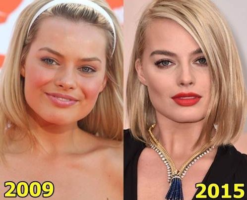 Plastic Surgery